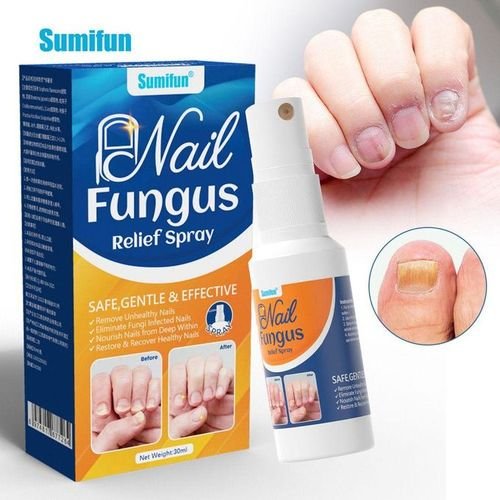 Sumifun Fungal Nail And Toenails Maximum Strength Antifungal Liquid Repair Nail Discoloration