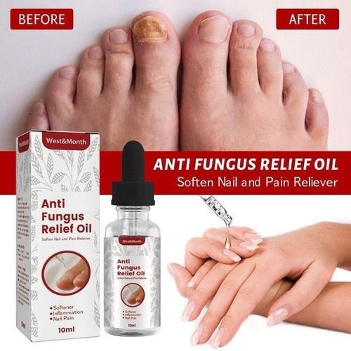 Antifungal Soothing Oil Foot Care Tool Inner Nail Repair Essence Pedicure Nail Whitening Anti-fungal Essential Oill